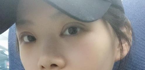 修志夫割雙眼皮的真實經(jīng)歷分享——莎吉特雙眼皮帶給我的蛻變!