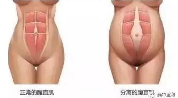 杭州美中宜和醫(yī)院口碑如何 高品質(zhì)醫(yī)療呵護(hù)母嬰健康