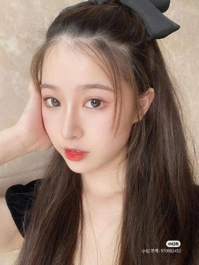 謝謝福州愛美爾朱剛強(qiáng)院長給做的鼻綜合,術(shù)后30天美美噠_點(diǎn)擊查看我的恢復(fù)情況