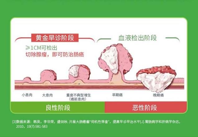 除了腸鏡,腸癌檢測(cè)方法還有它,無(wú)創(chuàng)無(wú)痛,在家就能做!