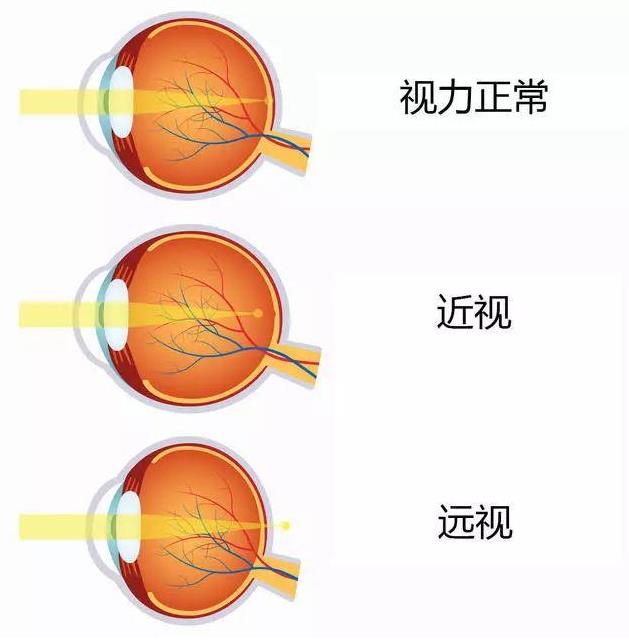 2021征兵即將開始 鄭州尖峰眼科助您實(shí)現(xiàn)軍旅夢(mèng)