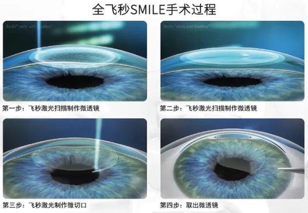 2021征兵即將開始 鄭州尖峰眼科助您實(shí)現(xiàn)軍旅夢(mèng)