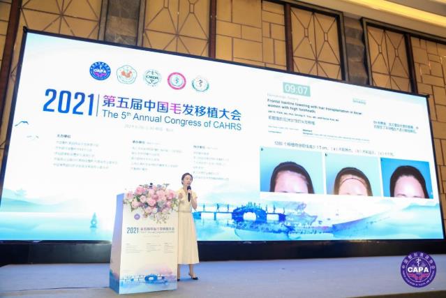 抗衰從頭開(kāi)始·杭市一程含皛出席2021中國(guó)毛發(fā)移植大會(huì)