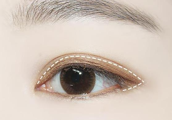 眼瞼上為什么會長脂肪粒?眼睛流淚不止是什么原因?
