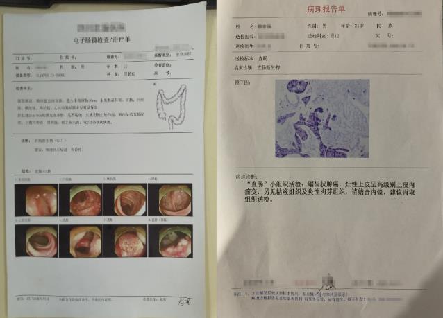 直腸癌有什么癥狀?聽聽四川肛腸醫(yī)院專家的分析