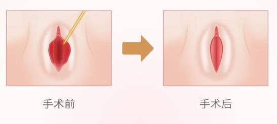 昆明美立方私密整形醫(yī)院,專注女性私密健康