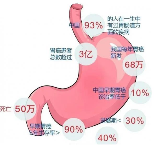 呼市東大肛腸醫(yī)院:無癥狀也能檢出胃早癌!五類人應早做篩查,無痛苦的磁控膠囊胃鏡