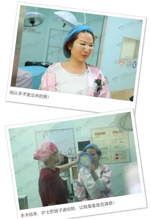 眼袋是怎么形成的,沈陽(yáng)杏林整形做眼袋多少錢