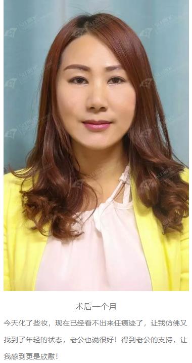 眼袋是怎么形成的,沈陽(yáng)杏林整形做眼袋多少錢