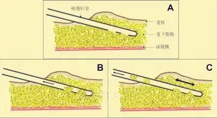 深圳悅美莉醫(yī)療門診部口碑怎么樣 誠信行醫(yī)溫馨服務(wù)