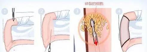 深圳悅美莉醫(yī)療門診部口碑怎么樣 誠信行醫(yī)溫馨服務(wù)
