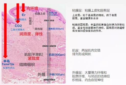 真閨蜜才會建議你做私密熱瑪吉!
