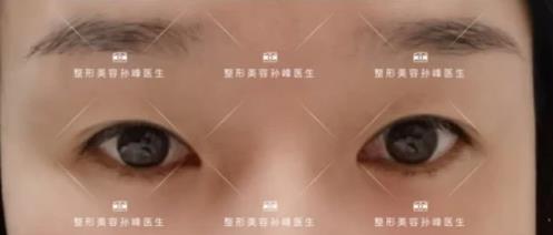 溫情時刻:這封1000字感謝信是對西安國際醫(yī)學(xué)中心整形醫(yī)院孫峰醫(yī)生的信任與期許