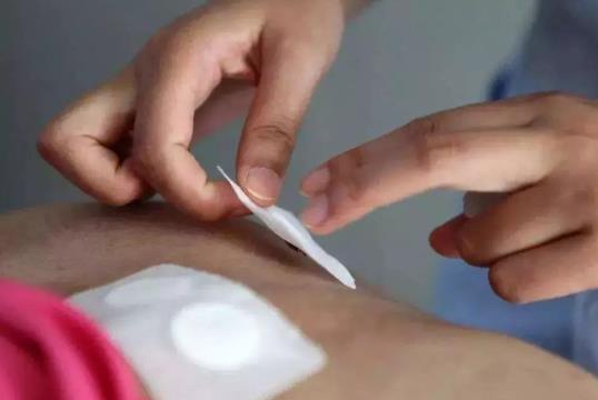 貼三伏貼懷孕了孩子能要嗎?生病期間可以貼三伏貼嗎?