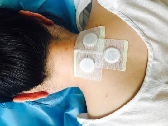 貼三伏貼要注意什么?懷孕貼三伏貼會對寶寶有影響嗎?