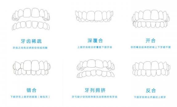 武漢德韓口腔暑期矯正咋樣?以人為本 打造燦爛笑容