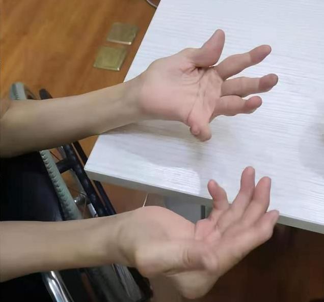 烈日炎炎!貴陽強直風濕病醫(yī)院呼吁風濕骨病患者進行“達標治療”“抗復發(fā)保關(guān)節(jié)”