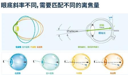 全視護(hù)丨青少年近視防控好幫手