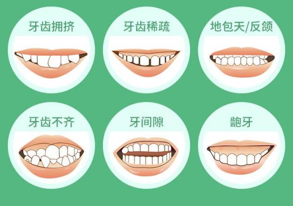 武漢德韓口腔矯正貴嗎?暑期限時(shí)拼團(tuán)活動(dòng)開(kāi)啟