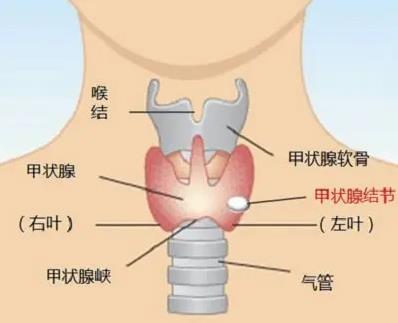 甲狀腺結(jié)多大算正常范圍之內(nèi)?武漢民生耳鼻喉醫(yī)院24h在線免費(fèi)咨詢預(yù)約