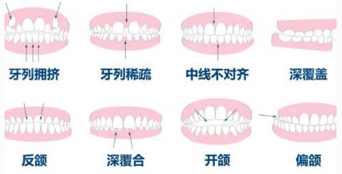 武漢牙齒矯正推薦哪家?德韓口腔暑期優(yōu)質(zhì)服務(wù)