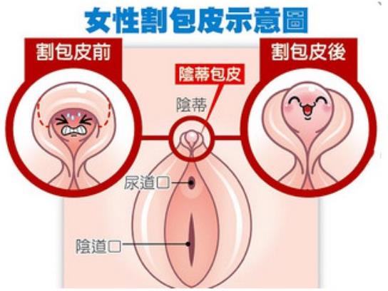 貴陽麗都私密整形醫(yī)院:帶你找回敏感性福生活
