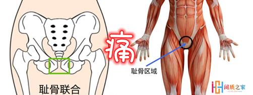 間質(zhì)性膀胱炎能治好嗎?尿頻尿痛不能吃什么?