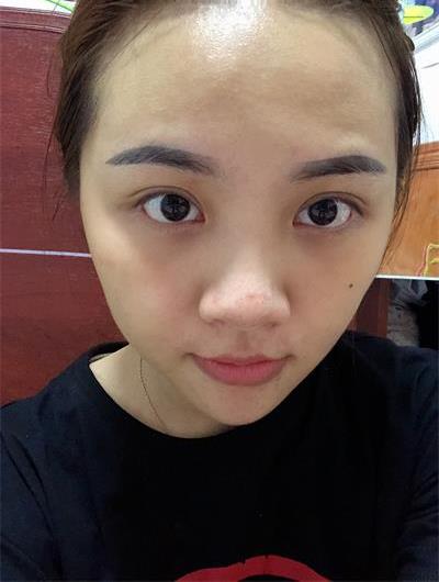 徐州y醫(yī)科匯美美容醫(yī)院綦孝堃院長解答:口唇整形前注意事項