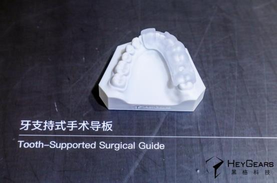 如何高效安全地完成即刻種植手術(shù)?