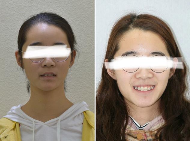 武漢仁愛口腔醫(yī)院靠譜嗎?三甲名醫(yī)云集展示種牙和正畸優(yōu)質(zhì)案例