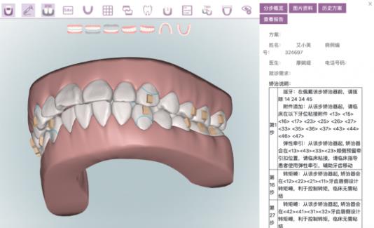 匠心科技,智造美麗——剖析美立刻隱形矯治器受青睞的原因