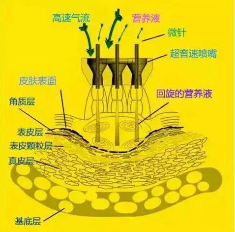 3支水光針中只有1支是正品?王的整形王鳳波教你看懂水光