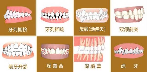 武漢德韓口腔牙齒矯正如何?拼團(tuán)活動限時(shí)開啟