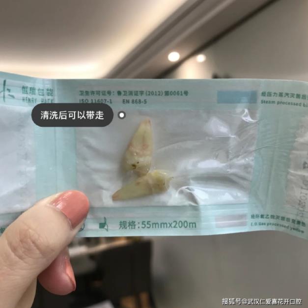網(wǎng)友:年齡大了還能矯正嗎?武漢仁愛口腔醫(yī)師告訴你:整牙任何時候都不晚!