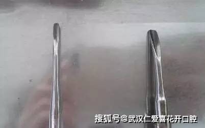 武漢哪家醫(yī)院拔牙技術(shù)好?武漢仁愛口腔微創(chuàng)拔牙,零創(chuàng)傷!