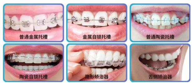 武漢德韓口腔暑期牙齒矯正口碑如何?優(yōu)質(zhì)技術(shù)品質(zhì)服務(wù)