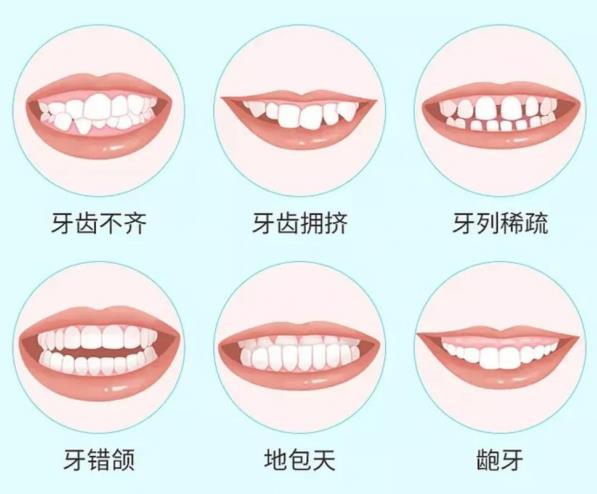 武漢哪個地方暑期牙齒矯正好?德韓口腔質(zhì)優(yōu)價廉