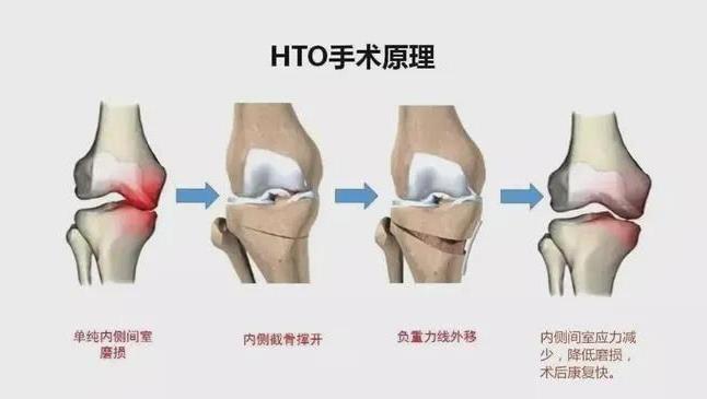 重慶紅樓醫(yī)院怎么樣?正規(guī)嗎?一流專家頂尖技術(shù)打造高效骨科醫(yī)院