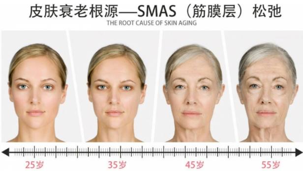 北京依一醫(yī)療美容焦?jié)升堻S金熱拉提2.0抗衰好嗎 黃金熱拉提2.0三大優(yōu)勢