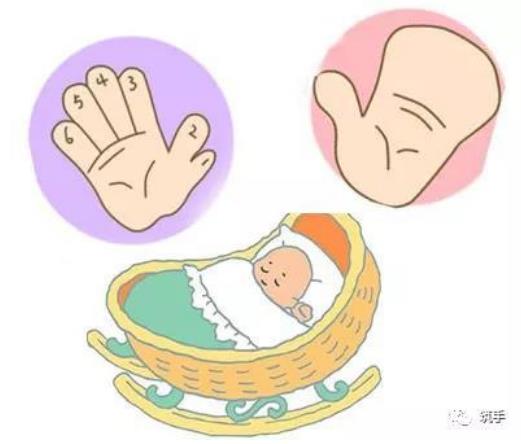 順德和平醫(yī)院手指再造怎么樣 先天性多指/并指畸形如何產(chǎn)生?如何治療?