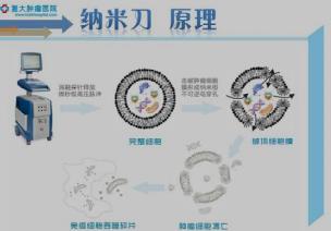 長沙腫瘤醫(yī)院推薦廣州復(fù)大腫瘤醫(yī)院:胰腺癌還有救嗎?