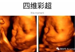 北京安太醫(yī)院做四維彩超正規(guī)嗎 收費(fèi)透明 誠(chéng)信公開(kāi)