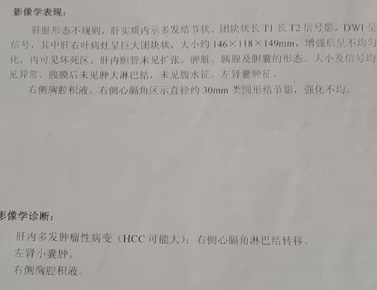 在線等-印度瑞戈非尼效果到底怎么樣啊?買(mǎi)一盒瑞戈非尼價(jià)格中國(guó)和印度為何不一樣?