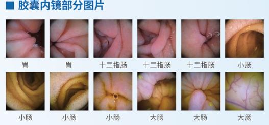 呼市東大肛腸醫(yī)院 最傷胃的行為,你天天都在犯!