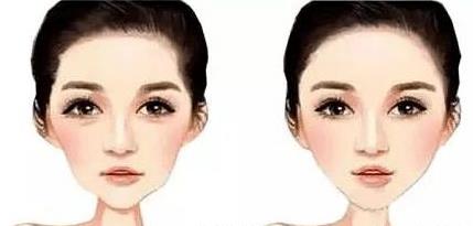 杭州鑫昕薇整形醫(yī)院怎么樣 鑫昕薇季黎明深度解析玻尿酸如何填充塑形的