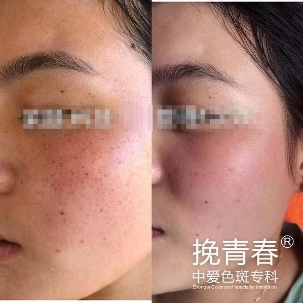 中愛·挽青春色斑?,整合式皮膚醫(yī)學(xué)研究中心