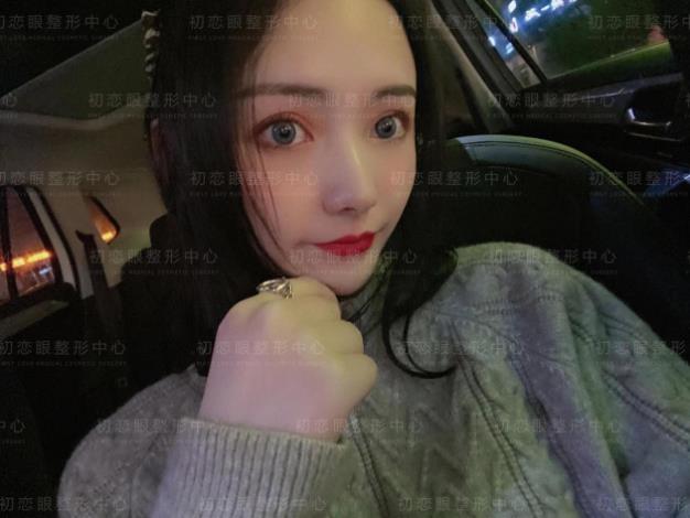 怎么設(shè)計(jì)才會好看 割雙眼皮就來南通初戀眼整形中心