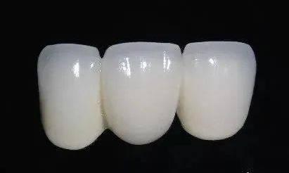 武漢仁愛(ài)口腔全瓷牙效果如何?能用多久?有什么優(yōu)勢(shì)?