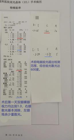 手術(shù)后視力能恢復(fù)到什么樣 普瑞眼科暑期摘鏡總動員