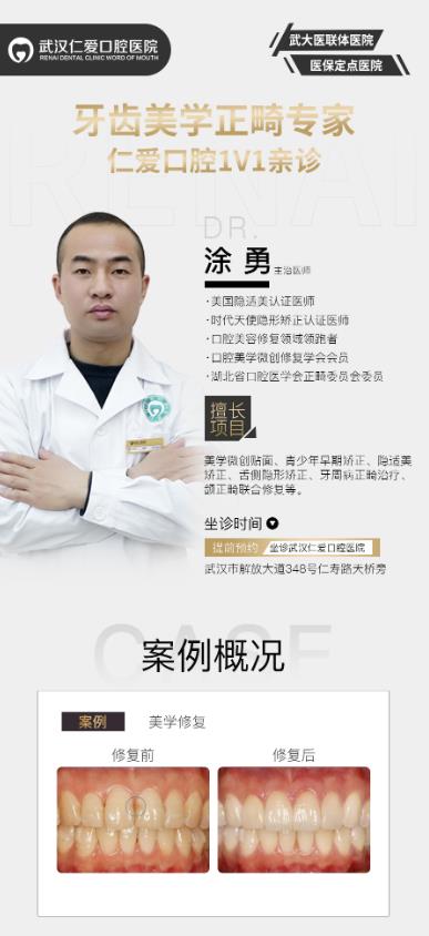 武漢哪家牙貼面專(zhuān)業(yè) 網(wǎng)友評(píng)價(jià):武漢仁愛(ài)口腔牙貼面專(zhuān)業(yè)靠譜